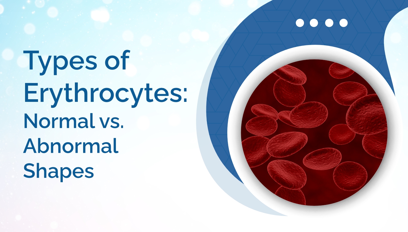 Types of Erythrocytes: Normal vs. Abnormal Shapes